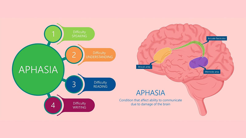 brain structure infographic